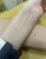 不能割太深